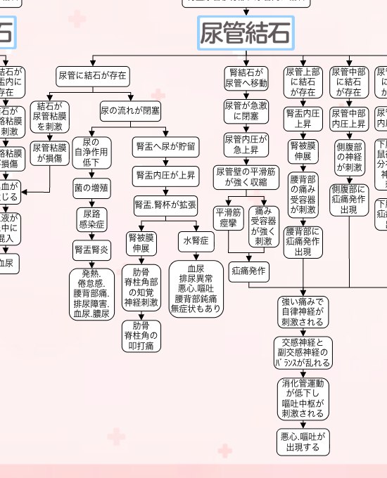 尿路結石の関連図：症状①側腹部痛