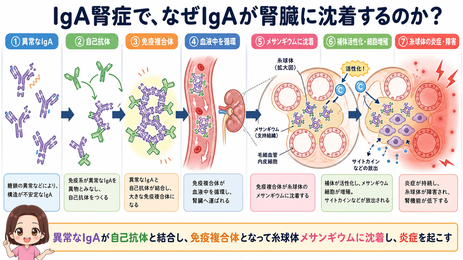 IgA腎症で異常なIgAが自己抗体と結合して免疫複合体となり、糸球体メサンギウムに沈着して炎症を起こすまでの流れの図解