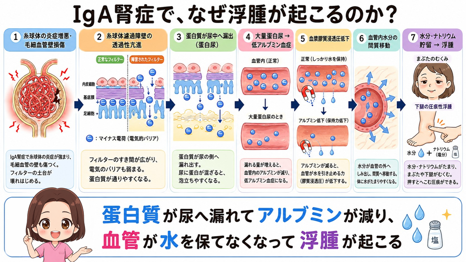 IgA腎症で浮腫が起こるしくみの図解。蛋白質の漏出から低アルブミン血症、血漿膠質浸透圧の低下、血管内水分の間質移動を経て浮腫に至るまでの7ステップ