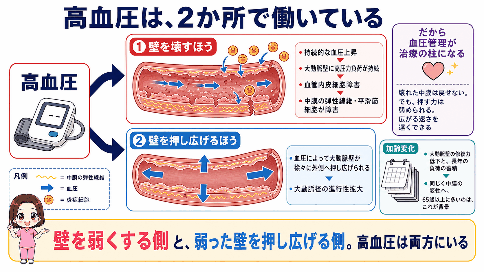 高血圧が2か所で働いていることを示した図解。血管内皮を傷つけて中膜を壊す働きと、弱った壁を外側へ押し広げる働きの両方を担っていることを示し、加齢変化の入口もあわせて示している