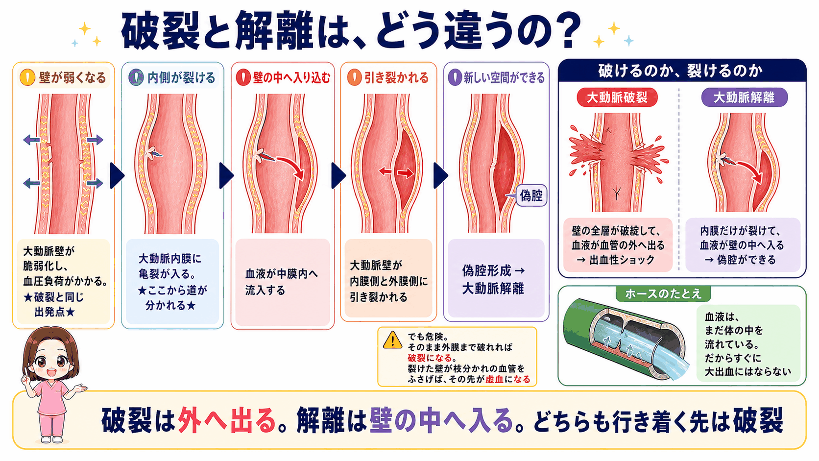 大動脈破裂と大動脈解離の違いを示した図解。内膜が裂けて血液が中膜内へ流入し偽腔ができる解離の流れと、壁の全層が破綻して血液が血管の外へ出る破裂を並べて比べている