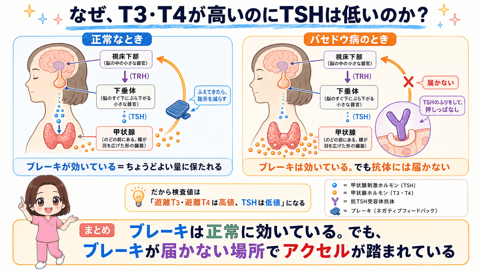 視床下部・下垂体・甲状腺のフィードバックを正常時とバセドウ病で比べた図解。抗体がTSHのふりをして受容体を押し続けるため、ブレーキが届かず、遊離T3・遊離T4は高値なのにTSHは低値になることを示している
