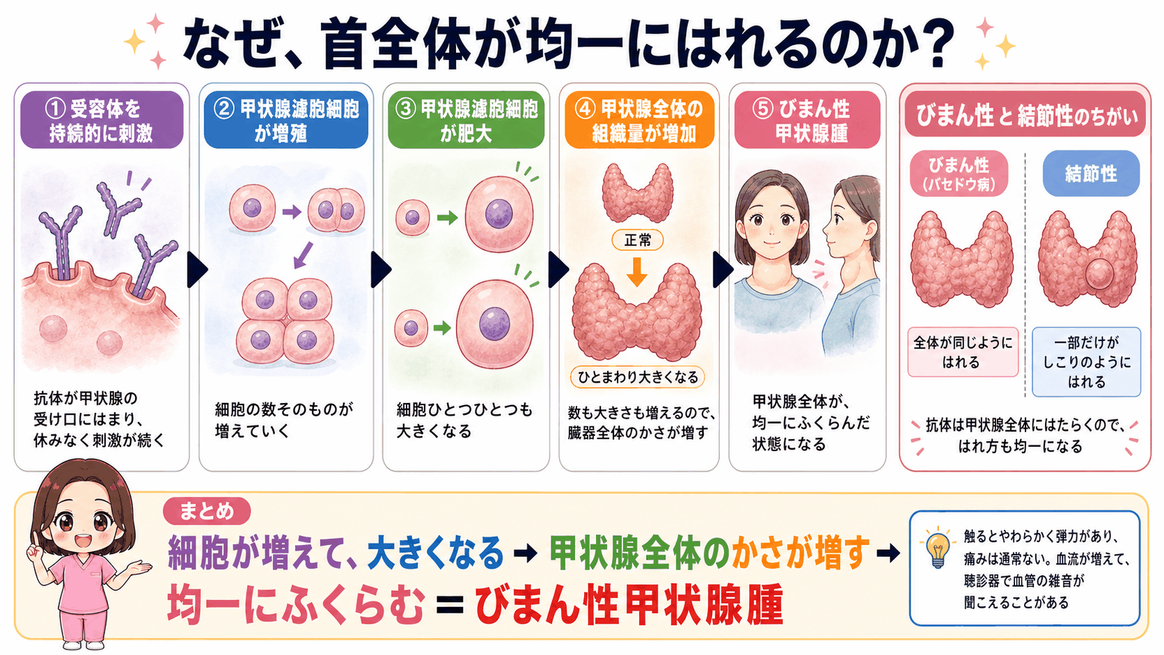 びまん性甲状腺腫ができるしくみの図解。甲状腺濾胞細胞が増殖して肥大し、甲状腺全体の組織量が増えて均一に腫大するまでの流れと、一部だけ腫れる結節性との比較
