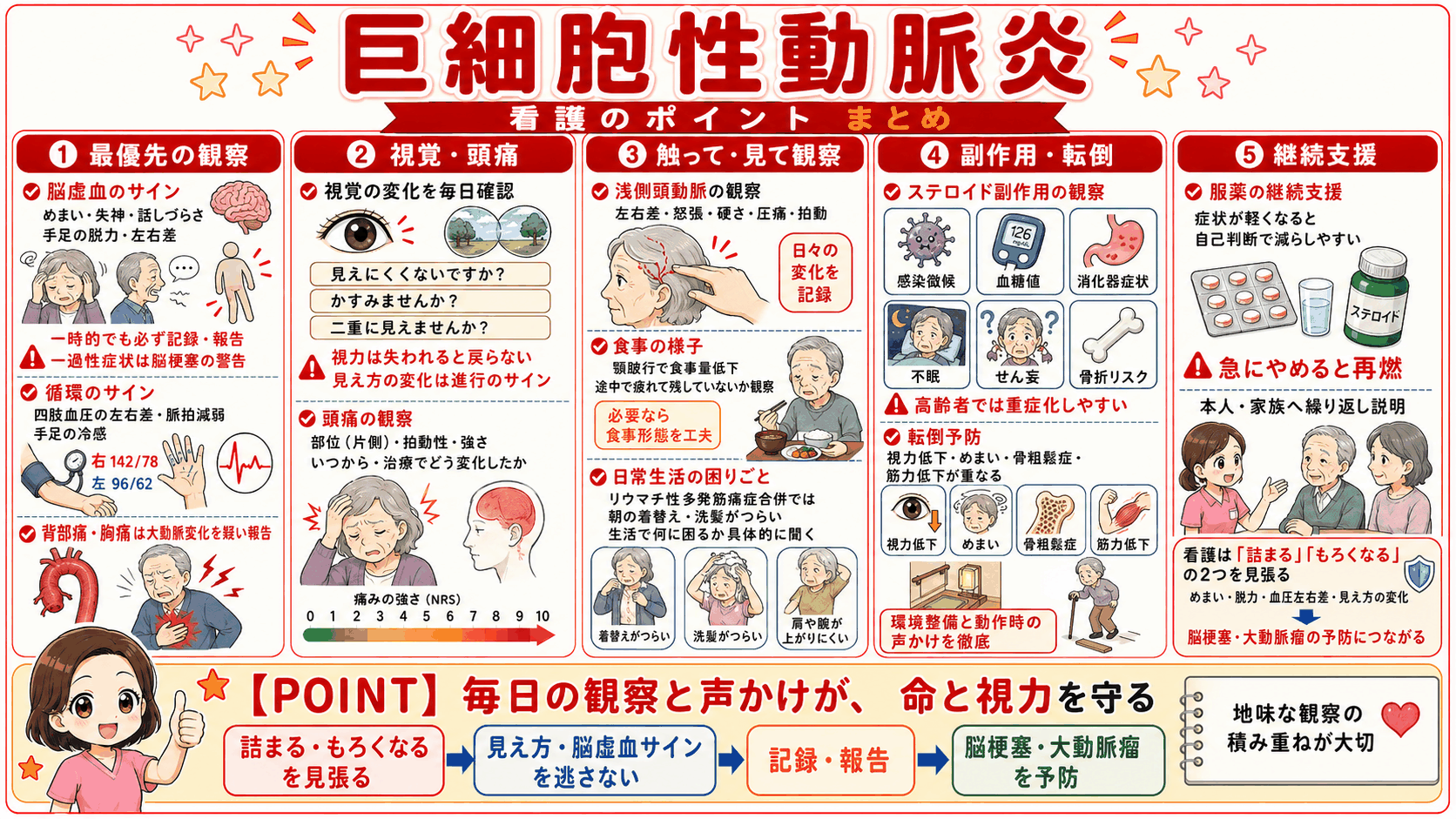 巨細胞性動脈炎の看護のポイントをまとめた図解。脳虚血のサインを最優先で観察すること、視覚の変化と頭痛の確認、浅側頭動脈を触って見る観察、ステロイド副作用と転倒予防、服薬の継続支援の5項目を示している