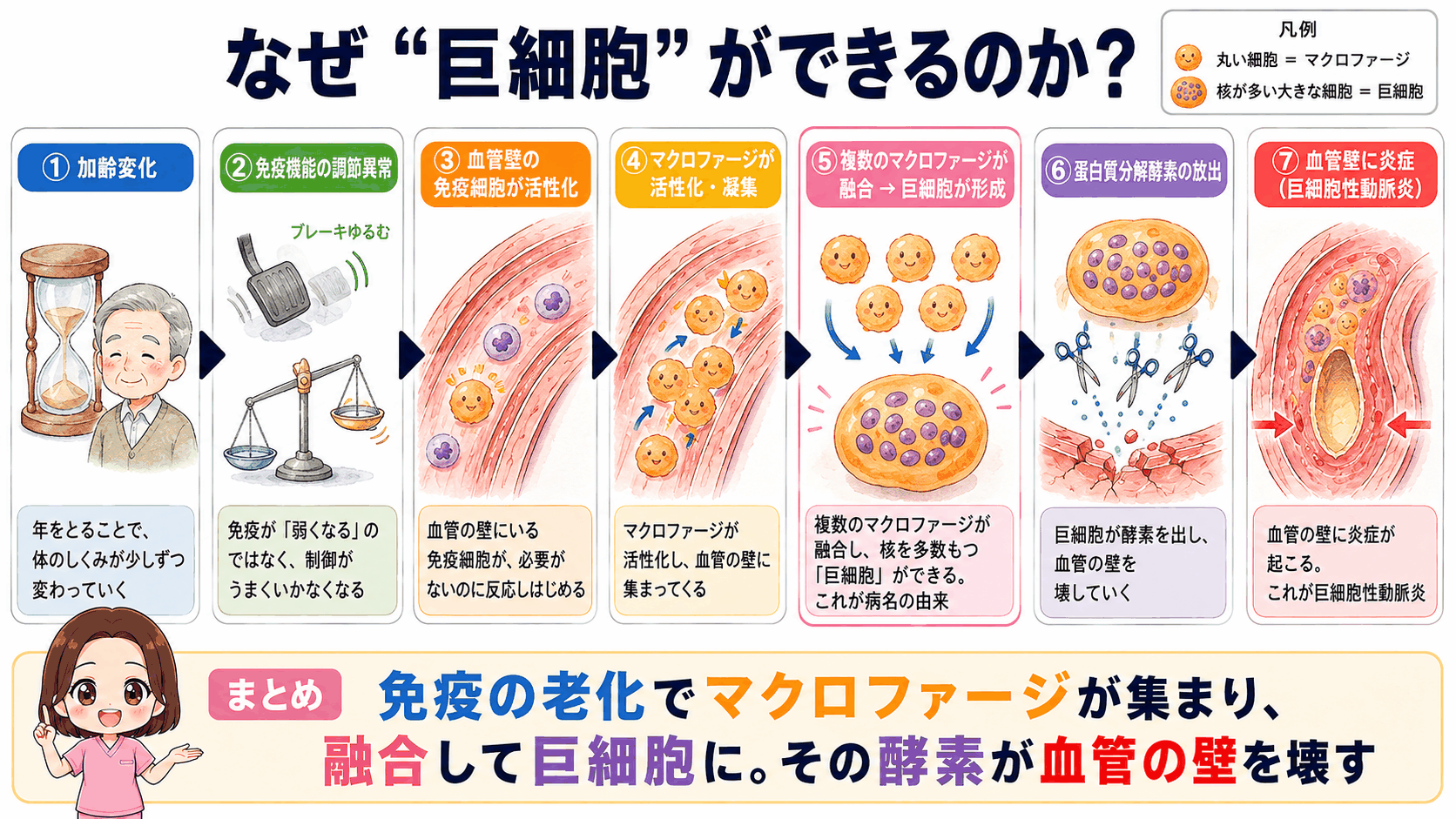 巨細胞ができるしくみの図解。加齢による免疫の調節異常からマクロファージが集まり、融合して巨細胞となり、酵素で血管壁を壊すまでの7ステップ