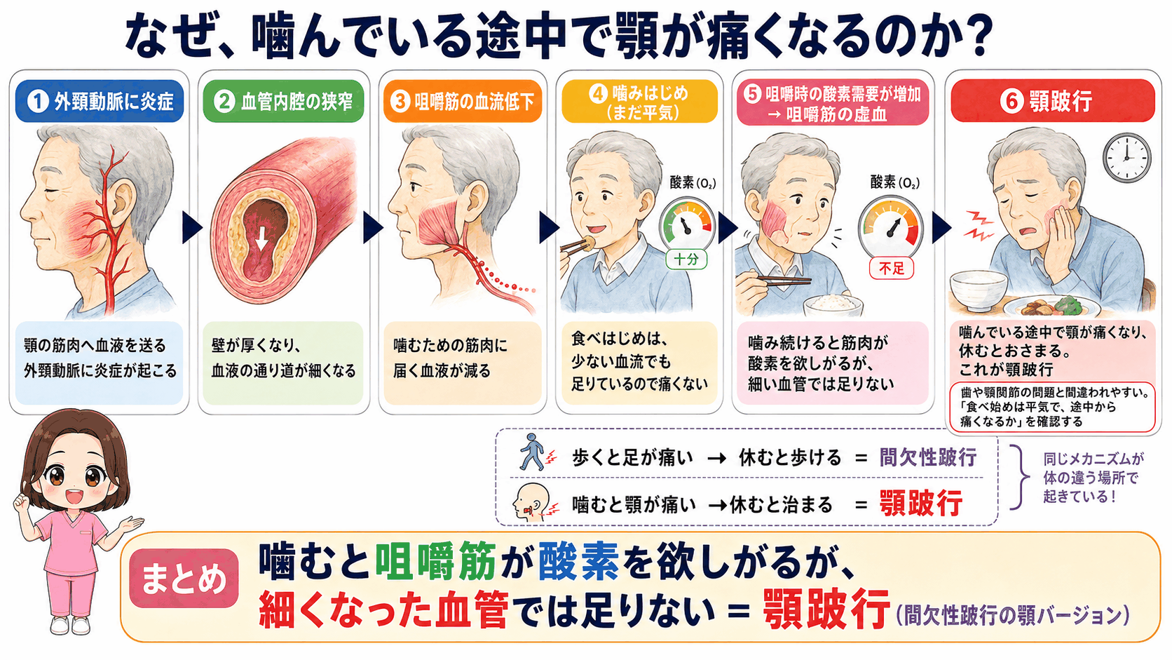 顎跛行が起こるしくみの図解。外頸動脈の狭窄から咀嚼筋の血流が低下し、噛み続けると酸素が足りなくなって顎が痛くなるまでの6ステップ。間欠性跛行との比較つき