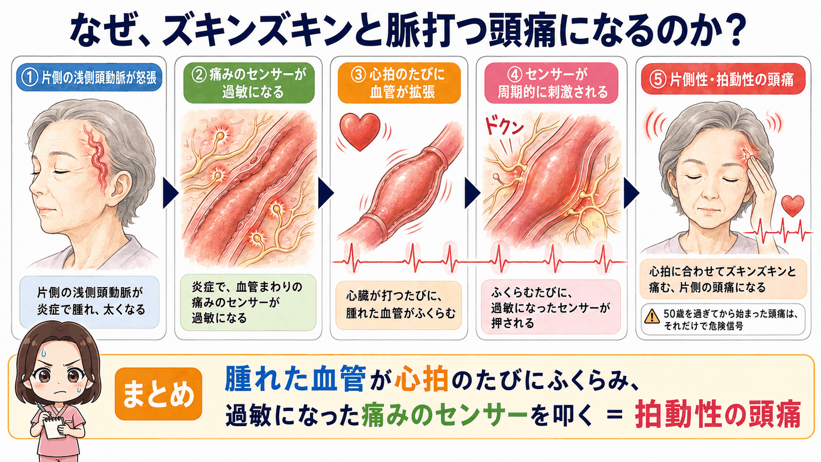 拍動性の頭痛が起こるしくみの図解。怒張した浅側頭動脈が心拍のたびに拡張し、過敏になった痛みのセンサーを周期的に刺激するまでの5ステップ