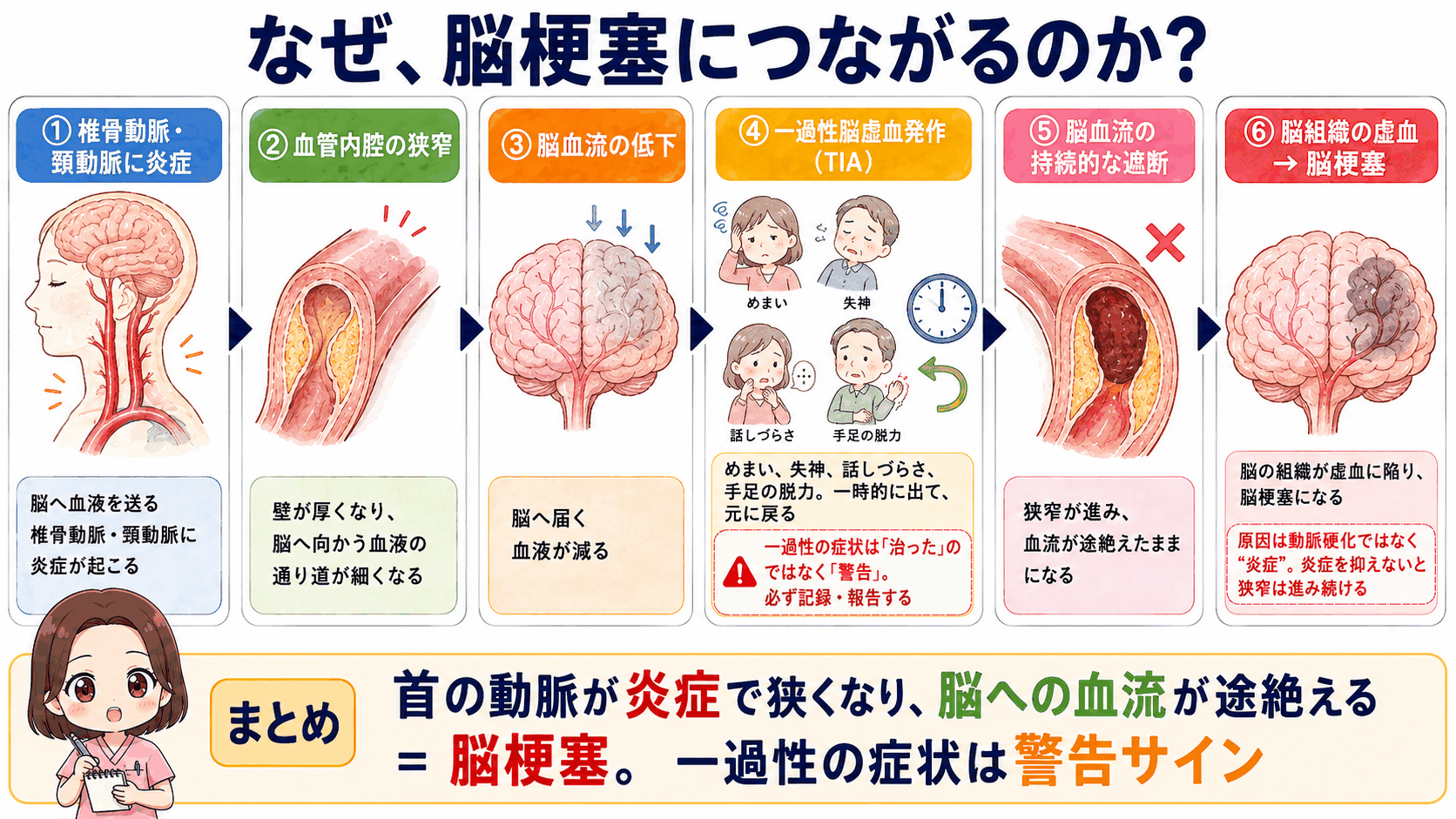巨細胞性動脈炎から脳梗塞に至るしくみの図解。椎骨動脈・頸動脈の狭窄から一過性脳虚血発作を経て、脳血流の持続的遮断による脳梗塞に至る6ステップ