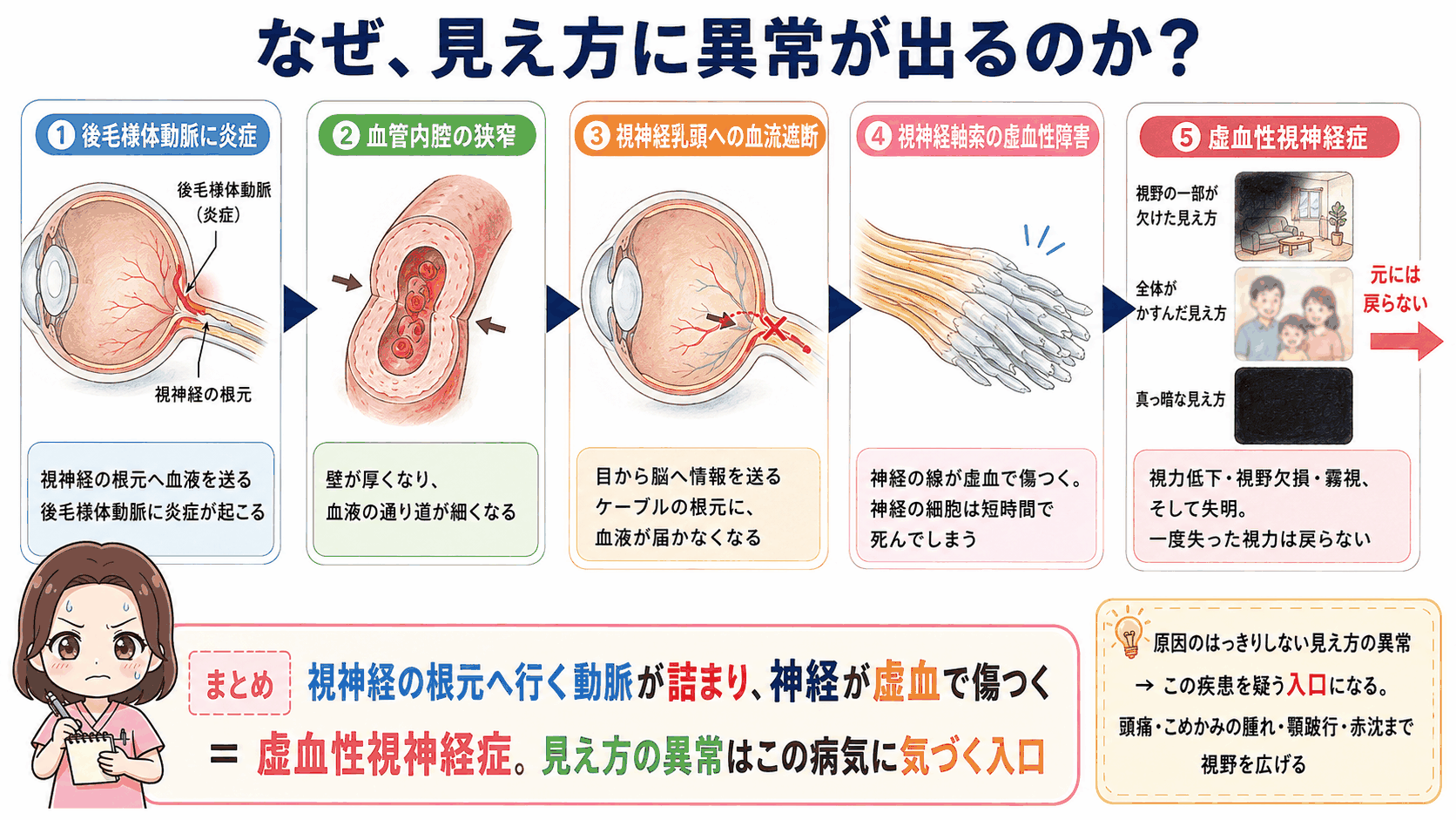 虚血性視神経症が起こるしくみの図解。後毛様体動脈の狭窄から視神経乳頭への血流が遮断され、視神経軸索が虚血で傷つき視力が失われるまでの5ステップ