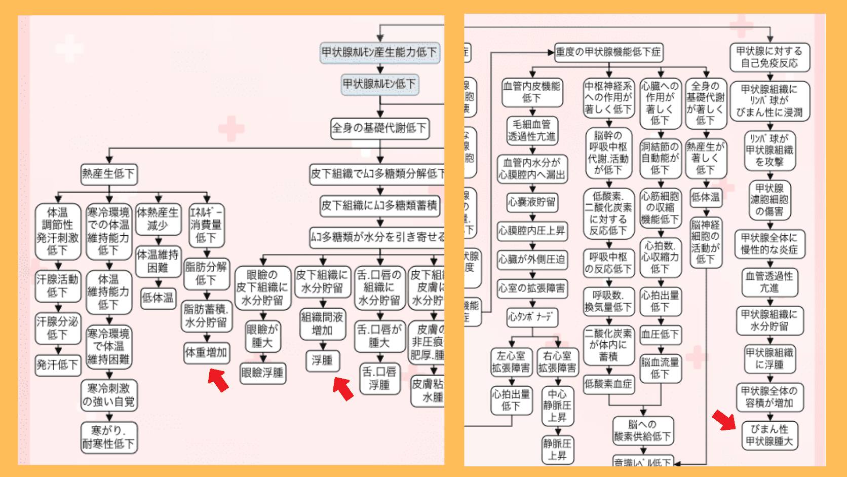 橋本病の症状の関連図。甲状腺ホルモン産生能力低下から全身の基礎代謝低下を経て、熱産生低下やムコ多糖類の蓄積による体重増加・浮腫に至る流れと、甲状腺に対する自己免疫反応からびまん性甲状腺腫大に至る流れを矢印でつないだ図