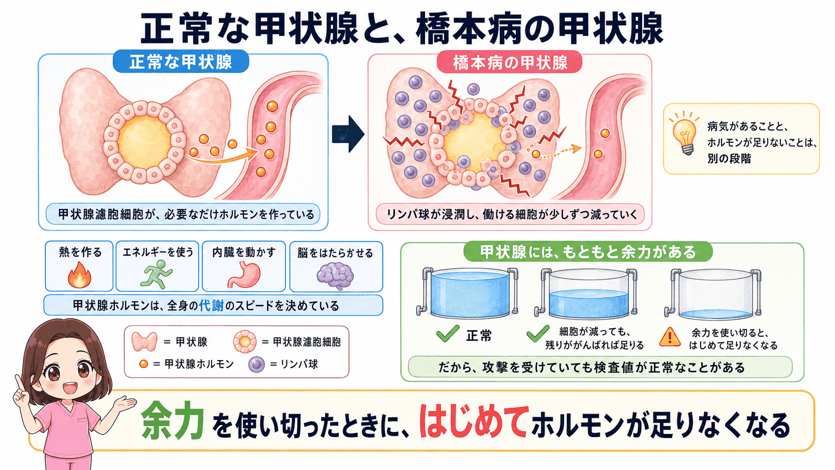 正常な甲状腺と橋本病の甲状腺を比べた図解。甲状腺濾胞細胞が必要なだけホルモンを作っている状態と、リンパ球が浸潤して働ける細胞が減っていく状態を並べ、甲状腺にはもともと余力があるため攻撃を受けていても検査値が正常なことがあると示している