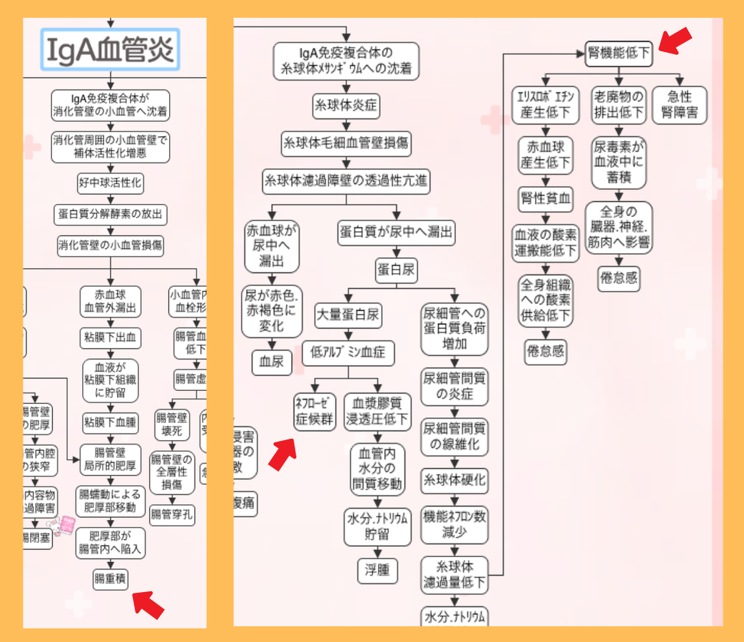 IgA血管炎の合併症の関連図。腸管壁浮腫から腸重積に至る流れと、糸球体メサンギウムへの沈着から腎機能低下・ネフローゼ症候群に至る流れ