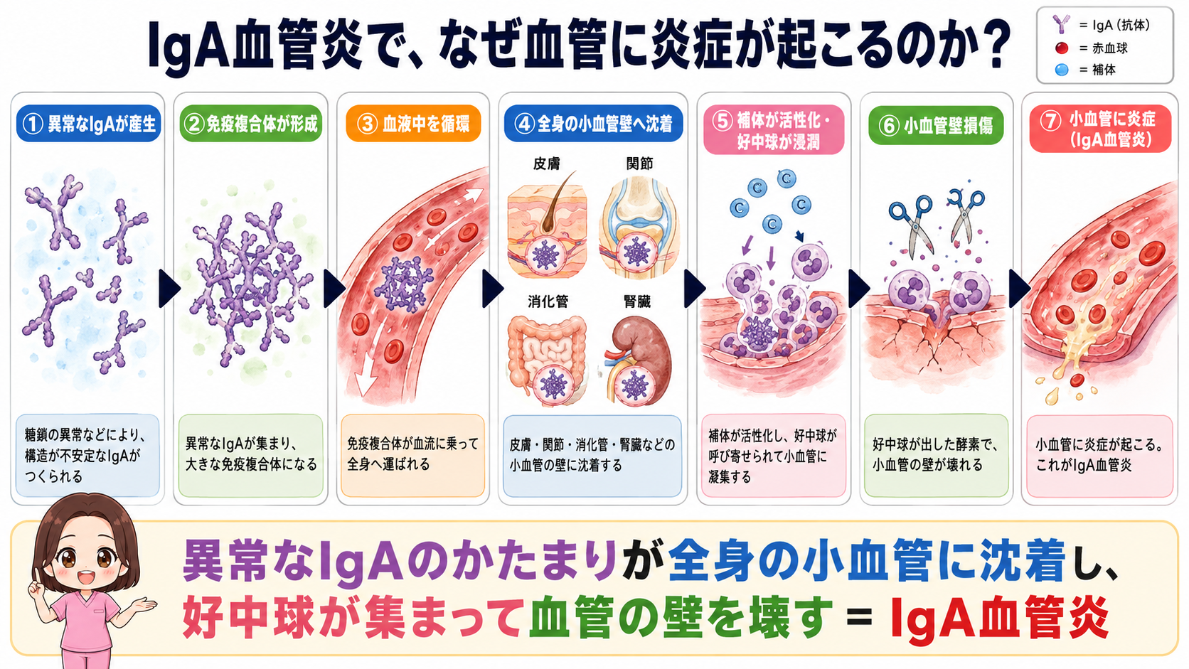 IgA血管炎で血管に炎症が起こるしくみの図解。異常なIgAの産生から免疫複合体の形成、小血管壁への沈着、補体活性化と好中球浸潤を経て小血管の炎症に至る7ステップ