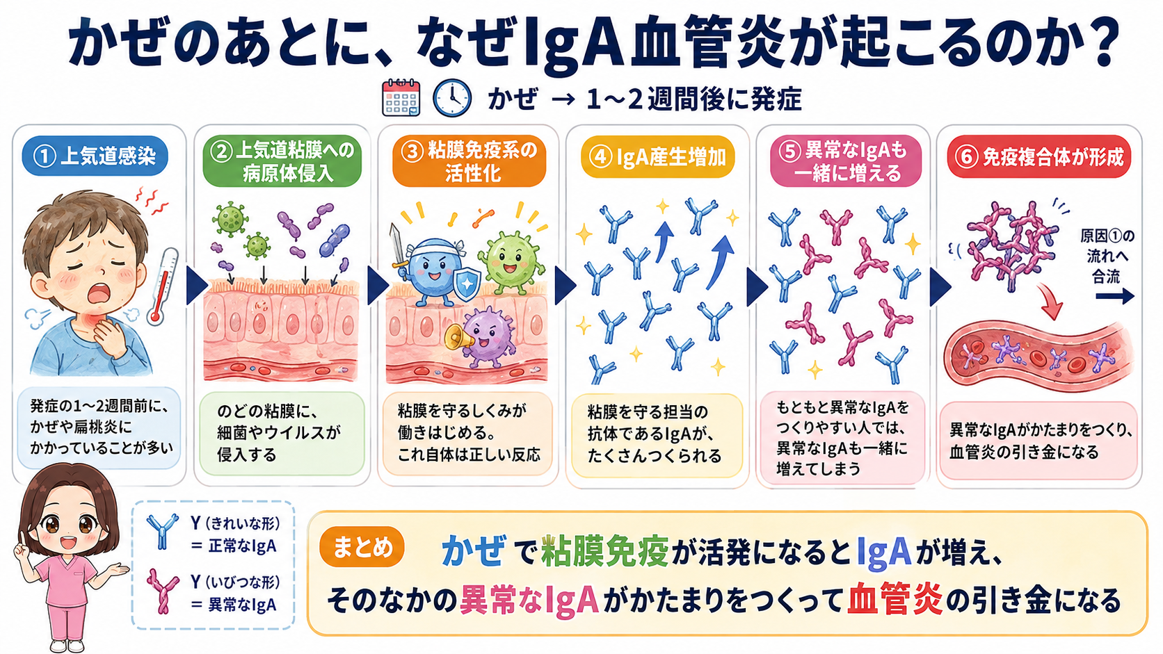 かぜのあとにIgA血管炎が起こるしくみの図解。上気道感染から粘膜免疫系の活性化、IgA産生増加を経て免疫複合体の形成に合流する6ステップ