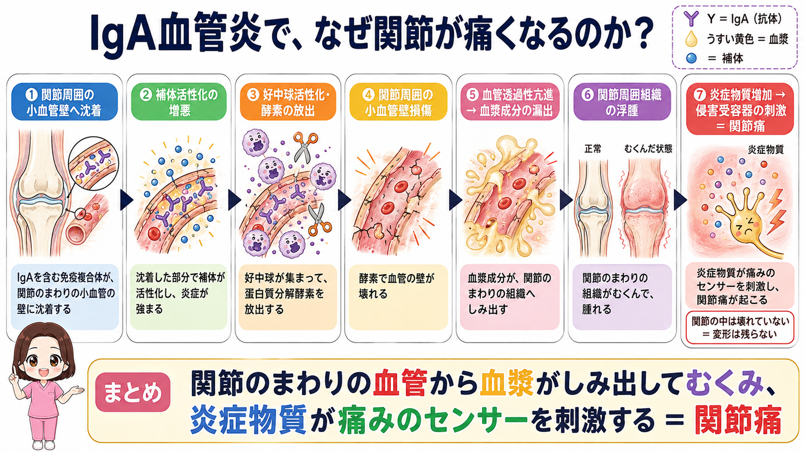 IgA血管炎で関節が痛くなるしくみの図解。関節周囲の小血管への沈着から血漿成分の漏出、関節周囲組織の浮腫を経て関節痛に至る7ステップ