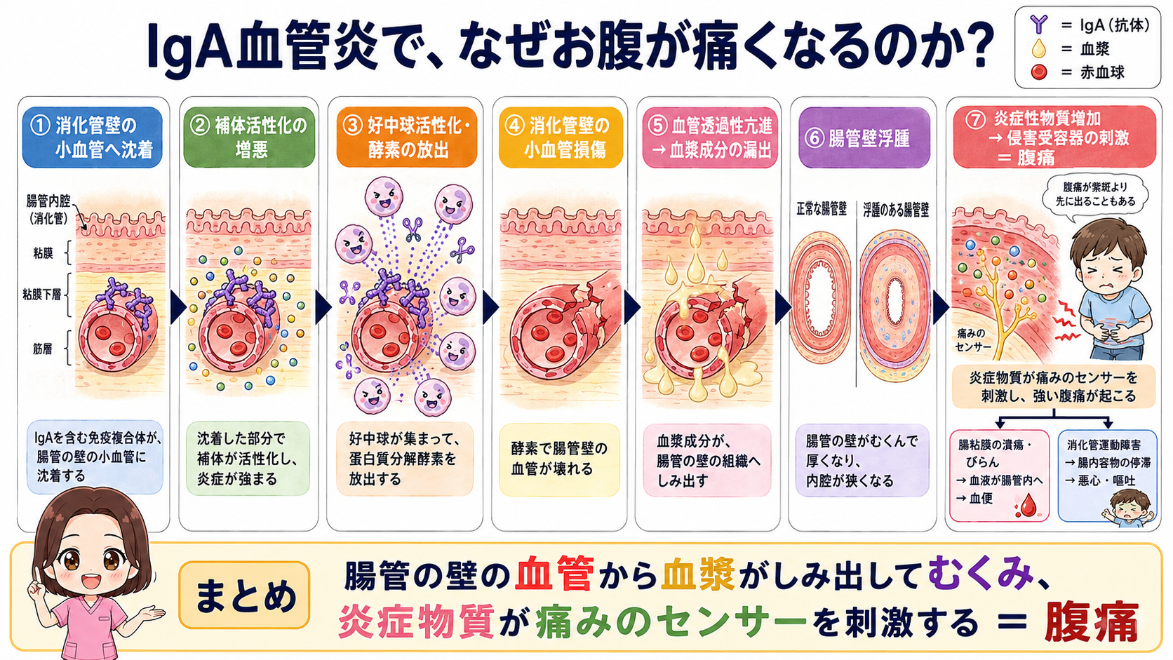 IgA血管炎で腹痛が起こるしくみの図解。消化管壁の小血管への沈着から腸管壁浮腫、炎症性物質の増加を経て腹痛・血便・悪心嘔吐に至る7ステップ