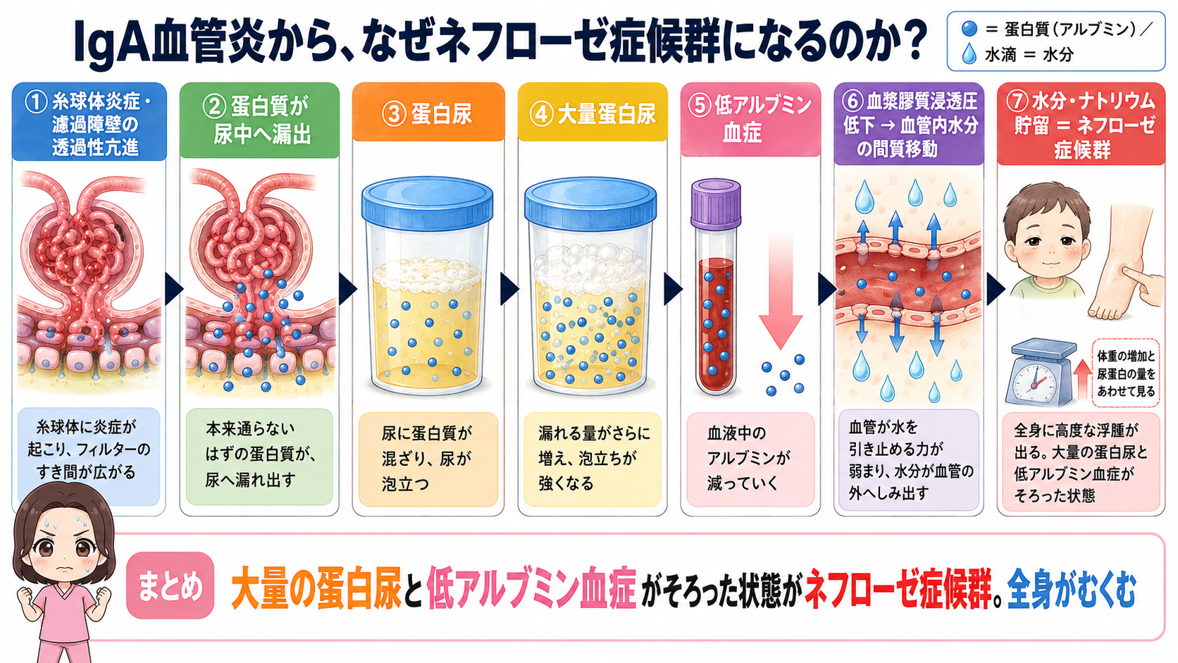 IgA血管炎からネフローゼ症候群になるしくみの図解。蛋白尿から大量蛋白尿、低アルブミン血症、膠質浸透圧低下を経て全身の浮腫に至る7ステップ