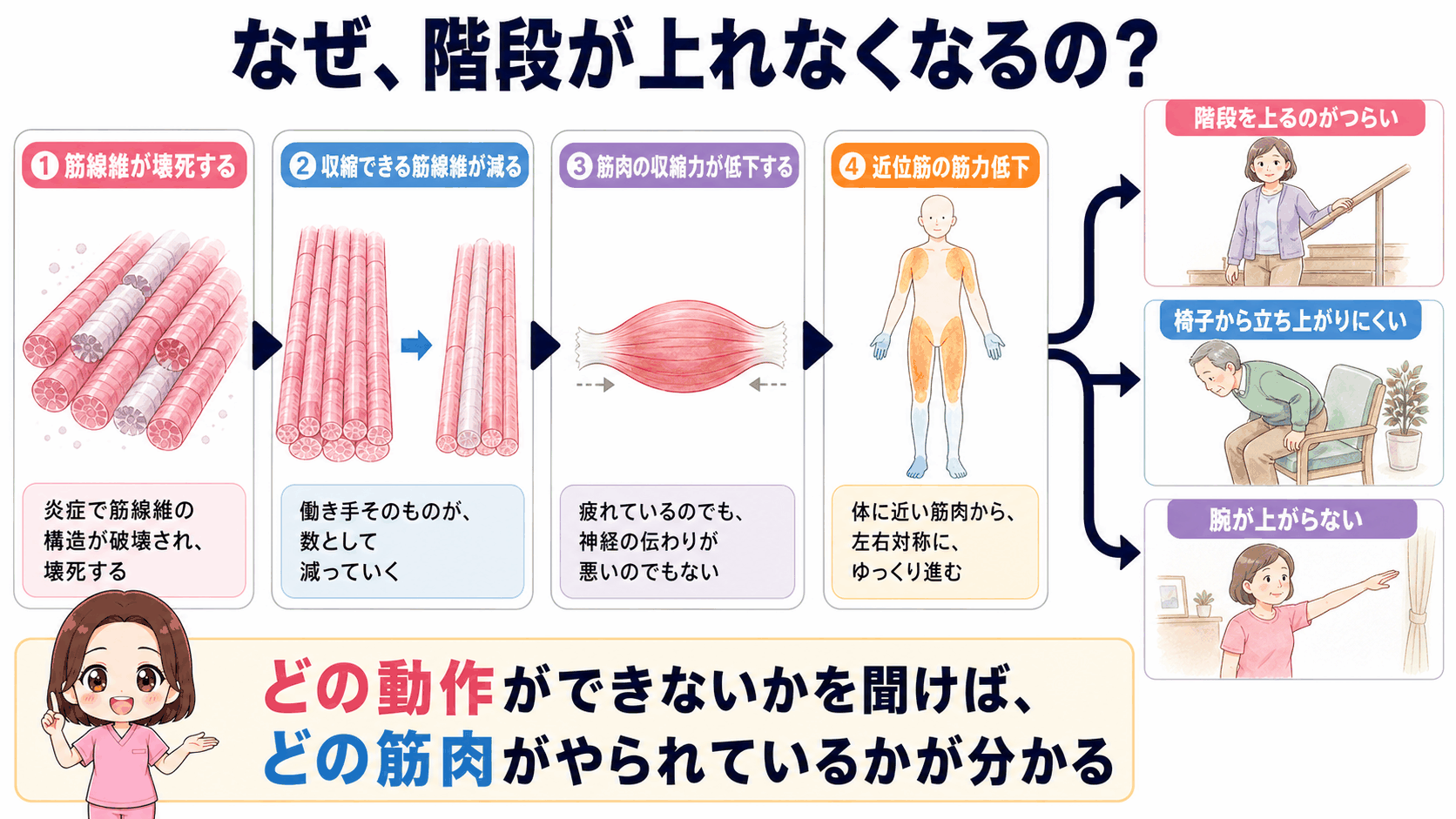 多発性筋炎の筋力低下のしくみの図解。筋線維が壊死して収縮できる筋線維が減り、筋肉の収縮力が低下して近位筋の筋力低下に至る流れと、階段が上れない・椅子から立ち上がりにくい・腕が上がらないという3つの訴えを示している