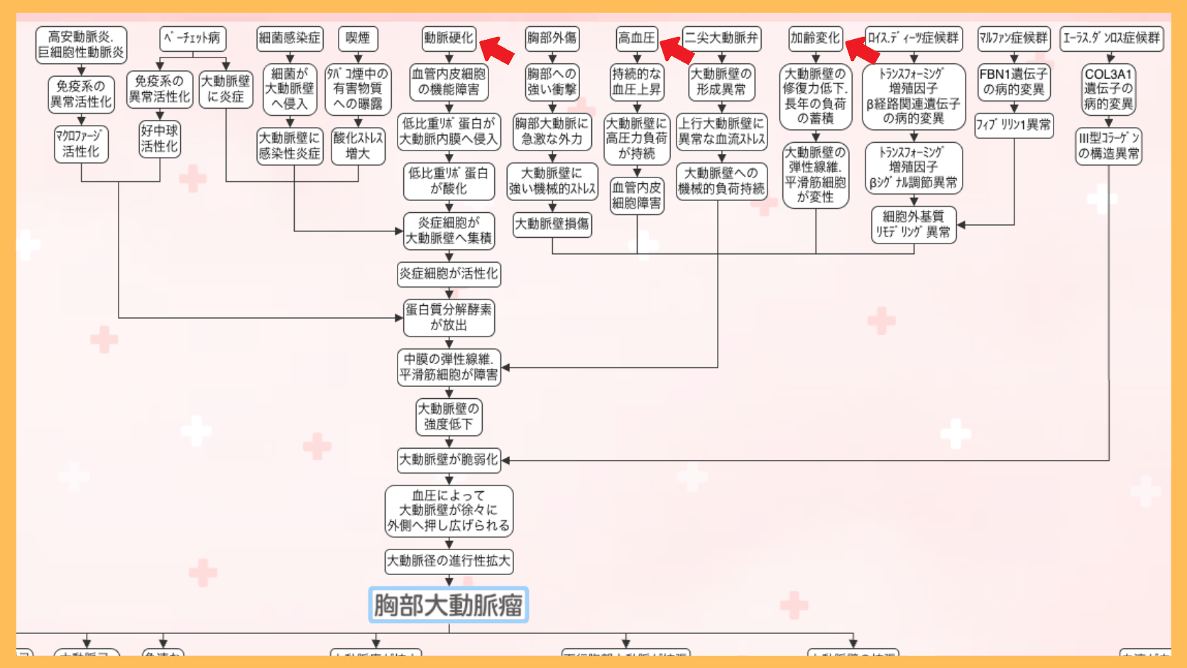 胸部大動脈瘤の関連図の全体像。赤い矢印で原因（動脈硬化・高血圧・加齢変化）の位置を示している