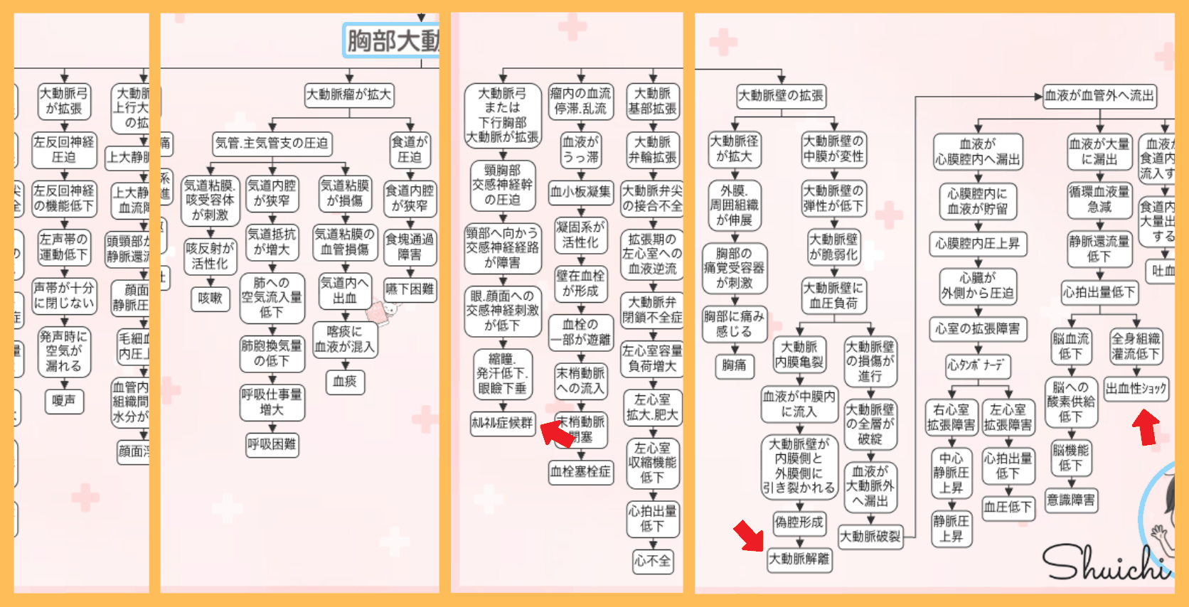 胸部大動脈瘤の関連図の全体像。赤い矢印で合併症（ホルネル症候群・大動脈解離・出血性ショック）の位置を示している