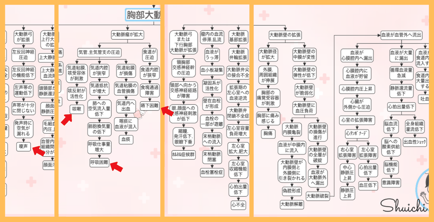 胸部大動脈瘤の関連図の全体像。赤い矢印で症状（嗄声・咳嗽・呼吸困難・嚥下困難）の位置を示している