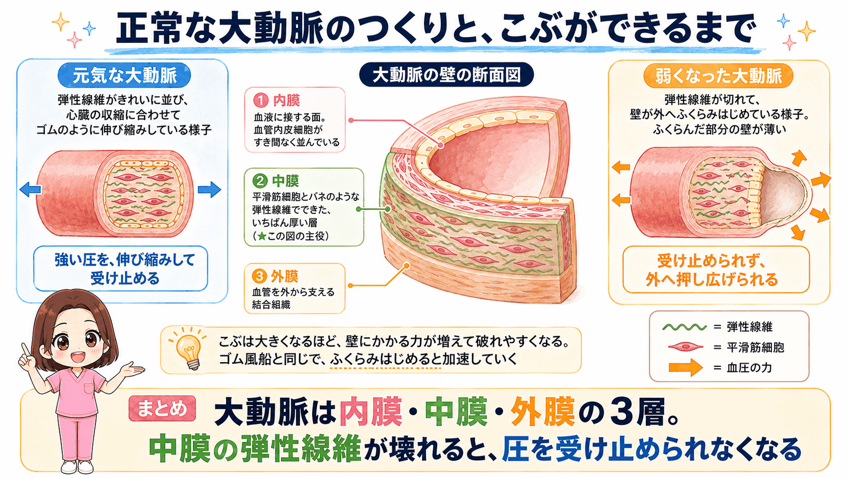 正常な大動脈の3層構造（内膜・中膜・外膜）と、中膜の弾性線維が壊れて壁が外へふくらむまでを、元気な大動脈と弱くなった大動脈で比べた図解