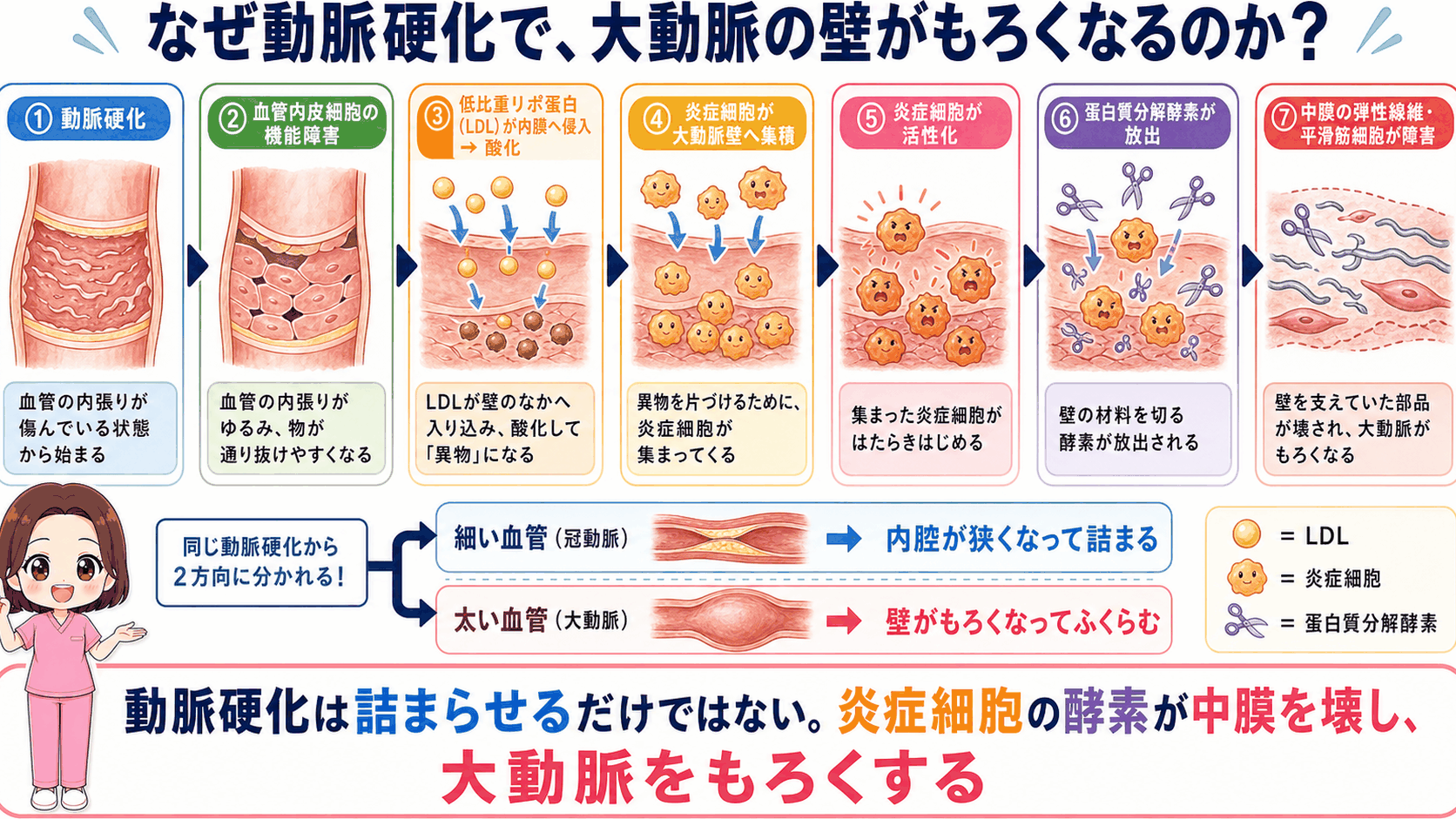 動脈硬化で大動脈の壁がもろくなるしくみの図解。LDLの侵入と酸化から炎症細胞が集まり、蛋白質分解酵素が中膜を壊すまでの7ステップ