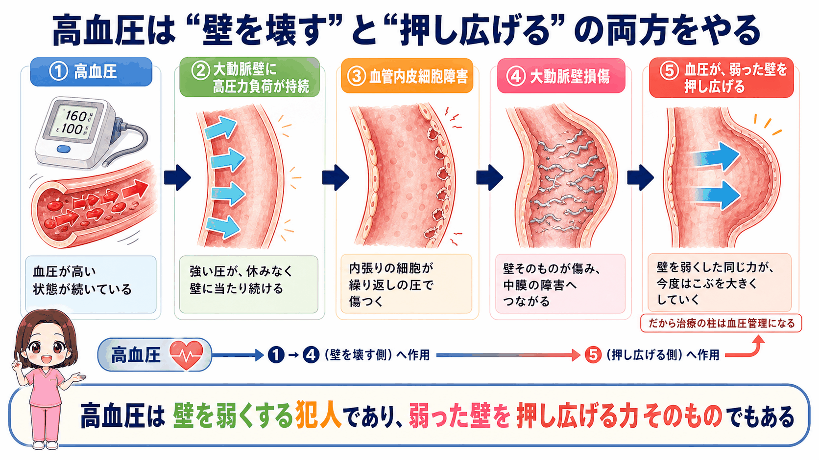 高血圧が大動脈壁を壊す側と、弱った壁を押し広げる側の両方に働くことを示した図解。血圧計は160/100