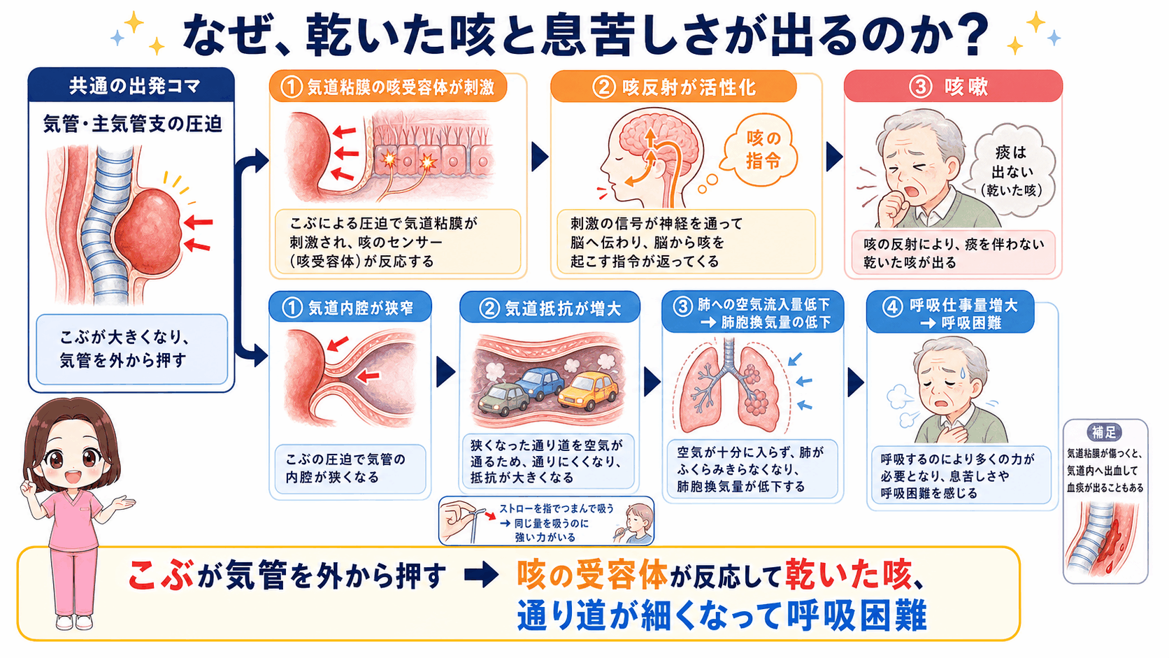 胸部大動脈瘤で乾いた咳と息苦しさが出るしくみの図解。気管・主気管支の圧迫から、咳嗽のルートと呼吸困難のルートに枝分かれする流れ
