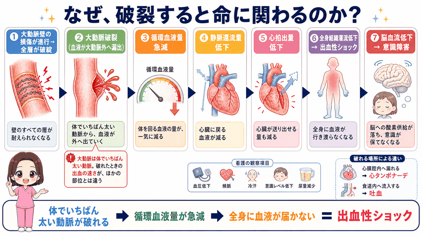 大動脈破裂から出血性ショックに至るしくみの図解。循環血液量の急減から心拍出量低下、全身組織灌流低下、意識障害までの7ステップ