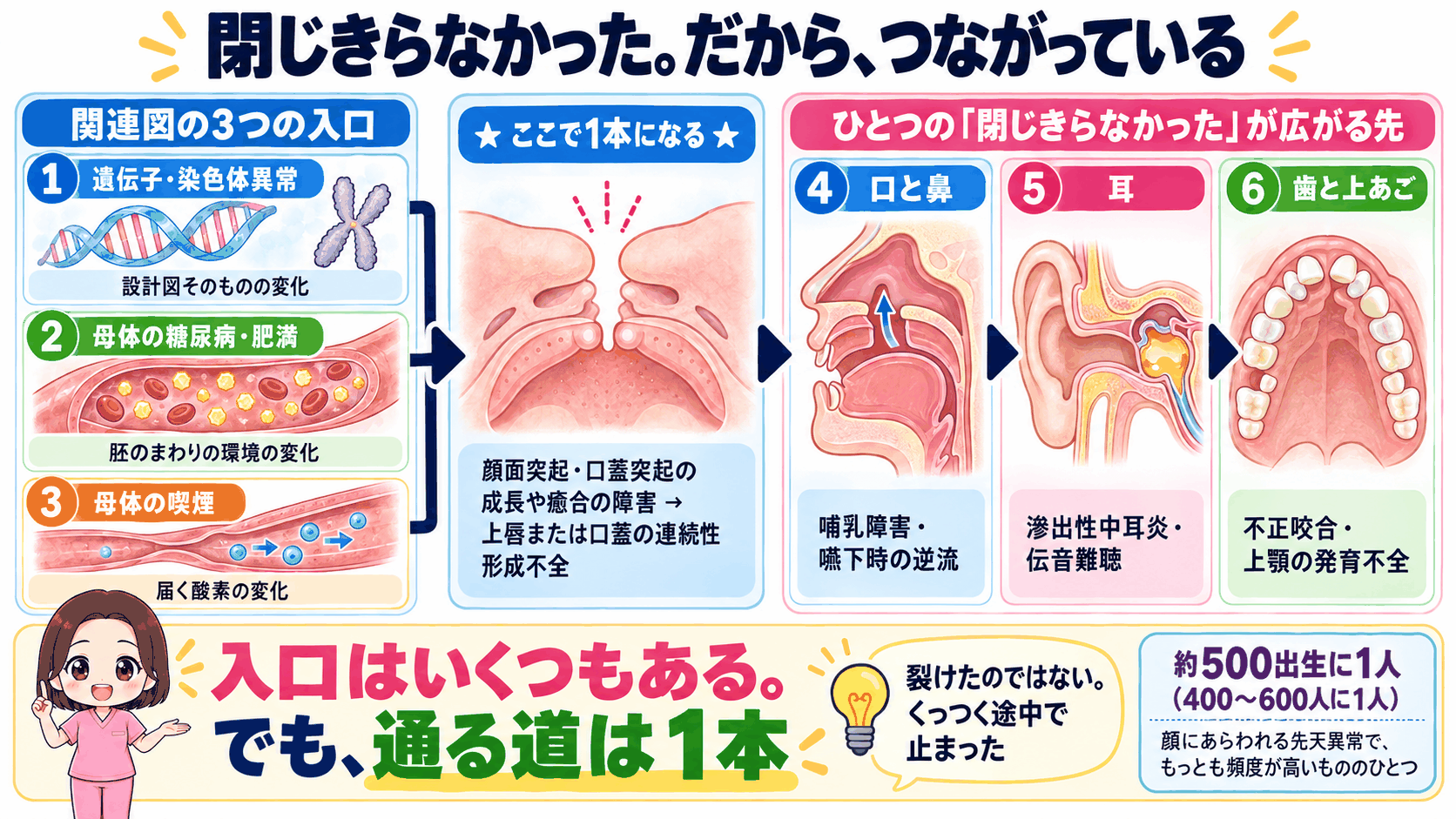 口唇裂・口蓋裂の全体像。3つの入口がひとつの道に合流し、口と鼻・耳・歯と上あごへ広がる