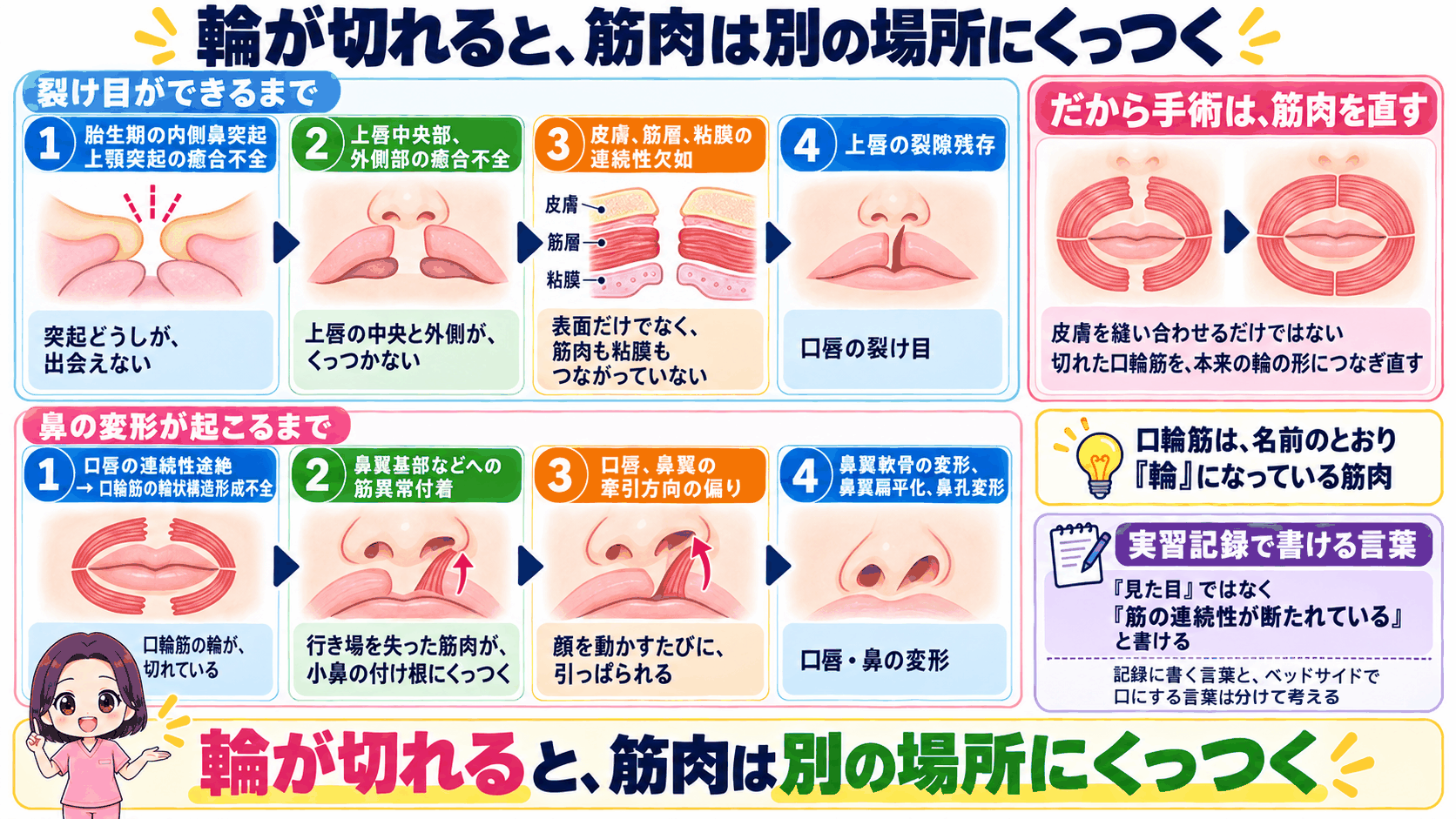 口輪筋の輪が切れて筋肉が小鼻の付け根に付着し、口唇と鼻の変形が起こるまでの流れ