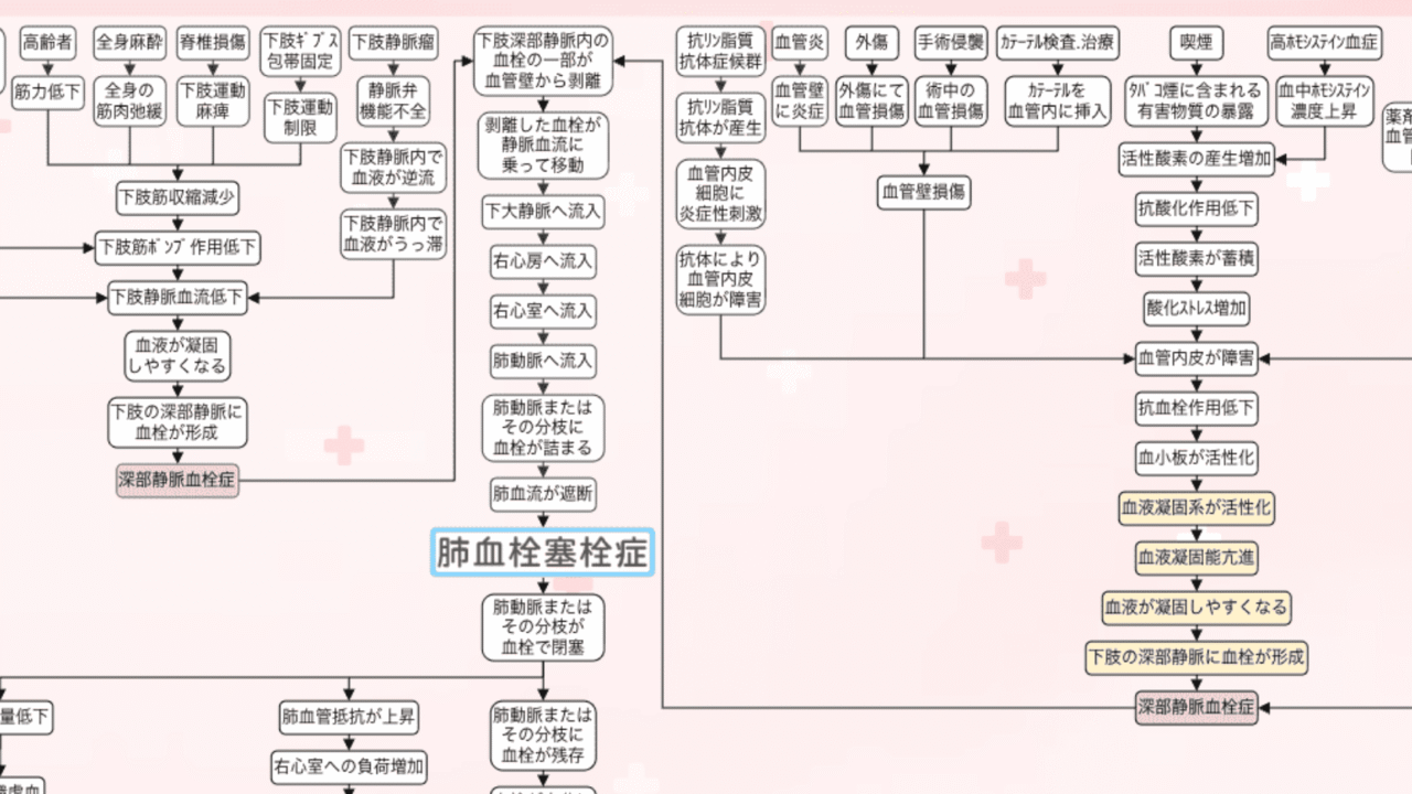 肺血栓塞栓症の関連図をイラストで解説